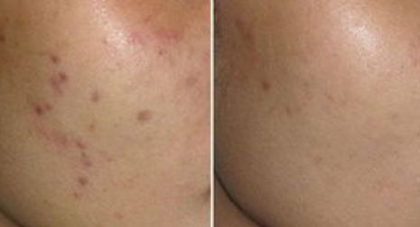 成都星范醫(yī)療美容整形醫(yī)院的醫(yī)生口碑如何？