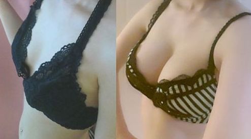 廣州哪家醫(yī)院做微針好？解讀廣州市內(nèi)頂尖微針治療機(jī)構(gòu)