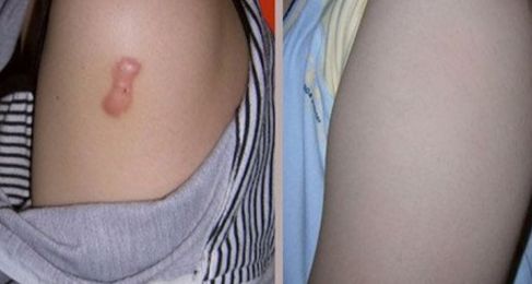 長沙整形哪家美容醫(yī)院好？專家揭秘長沙市頂級整形醫(yī)院排行榜！