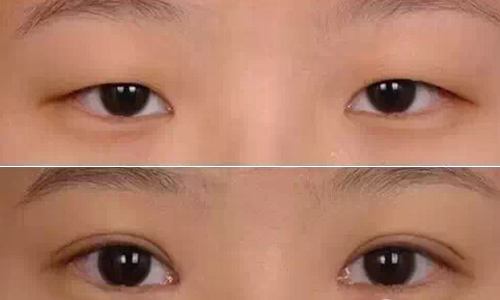 2023廣東肉毒素打細(xì)紋正規(guī)專(zhuān)家前十位(梁偉中、惠俐、匡斌概況、技術(shù)、口碑分析)