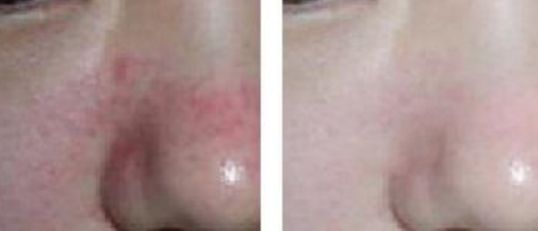 南京整鼻哪家醫(yī)院口碑好？