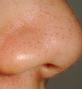 2023重慶填充動態(tài)細紋凹陷排行top10強的醫(yī)生(鄧穎&nbsp;、張代祿、田凱私立醫(yī)美有看頭)