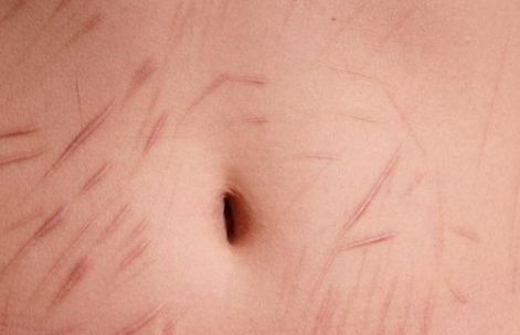 亳州哪家雙眼皮醫(yī)院口碑好，值得信賴？