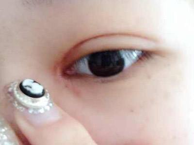 2023鄭州假體隆胸自體脂肪正規(guī)專家排名十強(屈秋芳、孫玉峰、宋賢磊實力口碑沒一個差的)