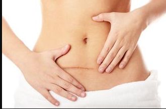 揭秘2023年杭州祛眼袋技術排行榜：誰家的祛眼袋效果最好