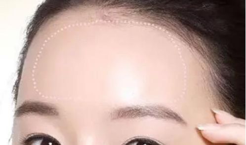 常州治療脫發(fā)哪家醫(yī)院靠譜？