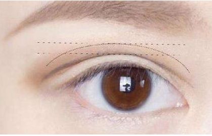 佛山哪家整容醫(yī)院的隆鼻效果出色？