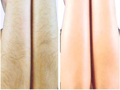 2023石家莊保妥適肉毒素注射前十強(qiáng)專家(任啟瑞、宋子軍、鄭鳳蘭技術(shù)、設(shè)備領(lǐng)先)