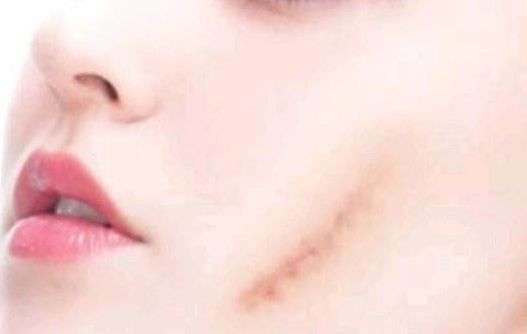 邢臺市下面部拉皮哪家好？匯總一線城市熱門醫(yī)院推薦