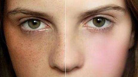 2023湖南生長紋填充玻尿酸十大專家口碑排行(周瑞春、吳倩、鄒勃生是強中強)