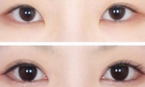 揭秘常州青春痘治療效果最好的五家醫(yī)院