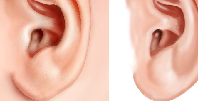 無錫看鼻子哪家醫(yī)院好？綜合評(píng)測(cè)揭秘?zé)o錫市專業(yè)鼻科醫(yī)院推薦