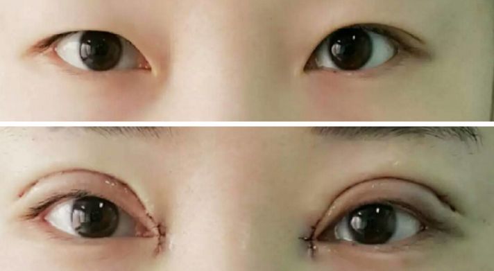 貴陽(yáng)哪家醫(yī)院熱瑪吉效果好，值得推薦？