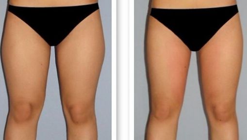 杭州疤痕醫(yī)院排名哪家好？揭秘杭州頂級(jí)疤痕醫(yī)院榜單！