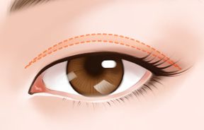 上海激光祛痣哪家醫(yī)院效果最好？