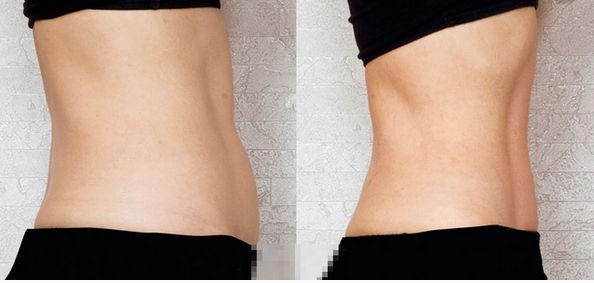 上海祛斑術(shù)哪家醫(yī)院好？解讀上海祛斑術(shù)醫(yī)院排名和專家推薦