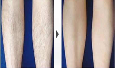 哈爾濱哪家醫(yī)院祛斑好？-排名第一的專業(yè)醫(yī)院，讓您擁有無瑕疵肌膚！