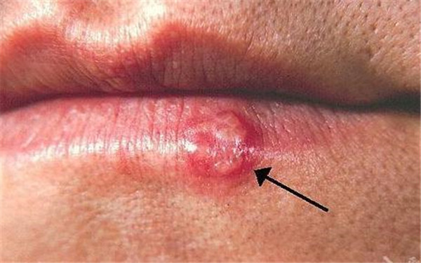 2023青島鼻小柱延長整形術(shù)醫(yī)生排名榜十強(qiáng)(張浩、季禾子、馬昕不一樣的擅長風(fēng)格體驗(yàn)也不同)