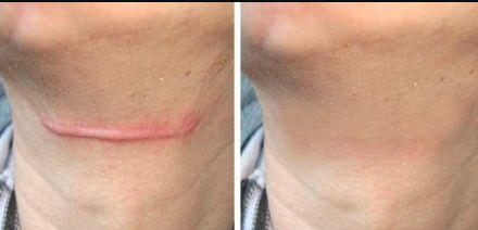 成都市開眼角醫(yī)院哪家好？選擇適合你的開眼角醫(yī)院