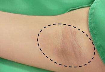 掌握關鍵！揭秘北京醫(yī)生，價值爆表！逐一評析前五大熱門選擇，成功摘取你所需的貼心醫(yī)療！