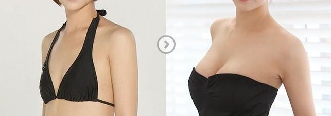 鄭州瘦臉針效果如何？一起探討哪家醫(yī)院好！