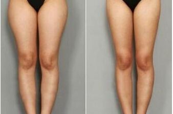 南寧皮膚外科醫(yī)院排名哪家醫(yī)院皮膚外科好？