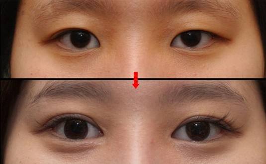 2023佛山大腿吸脂瘦腿專家評(píng)分前10強(qiáng)(謝漢平、曹碧浪、佛山曙光金子劉云忠龍頭地位穩(wěn)固)