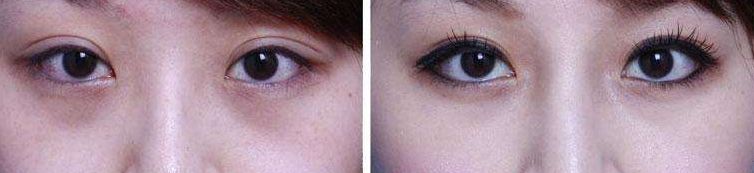 鄭州整容醫(yī)院排名，鄭州做整容找哪家醫(yī)院好