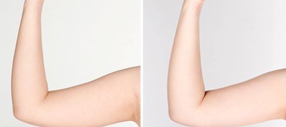 宿州雙眼皮醫(yī)院哪家好？揭秘宿州地區(qū)專業(yè)雙眼皮整形醫(yī)院