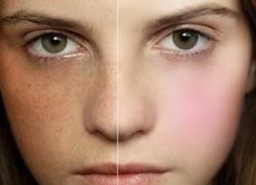 宿州疤痕修復(fù)醫(yī)院哪家好？幫你選擇最適合的宿州疤痕治療專(zhuān)科醫(yī)院