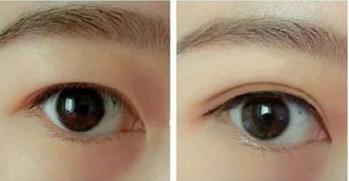 合肥熱瑪吉哪家醫(yī)院好？?jī)?yōu)質(zhì)服務(wù)與專(zhuān)業(yè)技術(shù)讓您擁有完美體驗(yàn)。