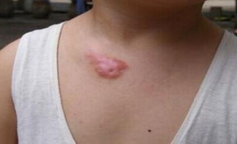 鄭州做鼻子修復(fù)哪家好？權(quán)威排名榜單解析！