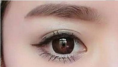 長沙哪位醫(yī)生擅長解燦割雙眼皮技術(shù)？