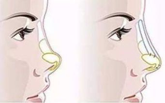 河南中醫(yī)藥大學(xué)第一附屬醫(yī)院整形科技術(shù)與醫(yī)生表現(xiàn)口碑如何？