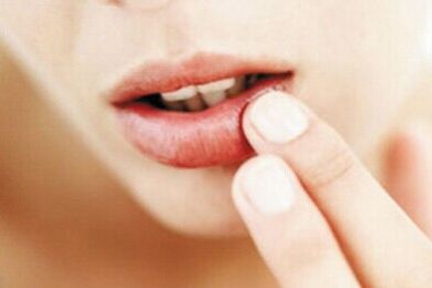 2023濟(jì)南激光祛眼睛細(xì)紋醫(yī)生前10強(qiáng)排名榜(李文德、王曉林、趙峰值得信賴和選擇！)