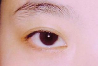 西安看胎記醫(yī)院哪家好？選擇胎記?？漆t(yī)院，專業(yè)技術(shù)得到用戶好評(píng)！