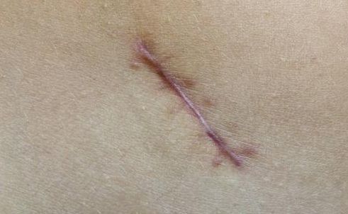 重慶整形技術(shù)，哪家醫(yī)院好？探尋重慶整形技術(shù)最佳醫(yī)院有哪些