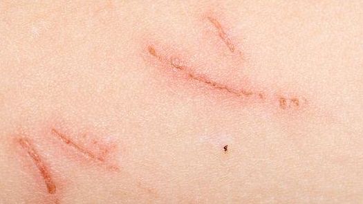 開封哪家醫(yī)院的減肥治療效果最好？