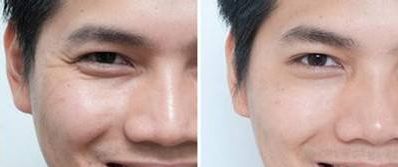 南京哪家整形醫(yī)院隆鼻效果最好？