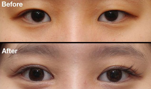 昆明刀疤修復(fù)哪家醫(yī)院好？挑選昆明專業(yè)刀疤修復(fù)醫(yī)院的技巧與要點(diǎn)