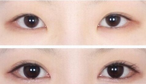 濟南哪家醫(yī)院的豐胸手術(shù)效果最好？