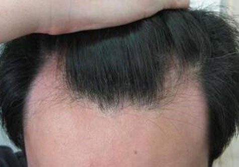 廣州曙光醫(yī)學美容醫(yī)院周展超潔膚法體驗分享