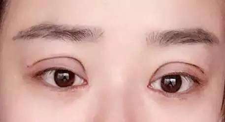 2023廣州乳房下垂上提口碑醫(yī)生(馮雪貞、王鋒、盧仕良既權(quán)威技術又先進)