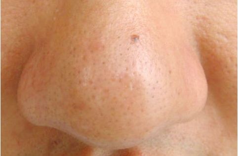 福州陳勉曾醫(yī)療美容診所怎么樣？福州陳勉曾醫(yī)療美容診所簡介|醫(yī)生團隊|口碑評價！