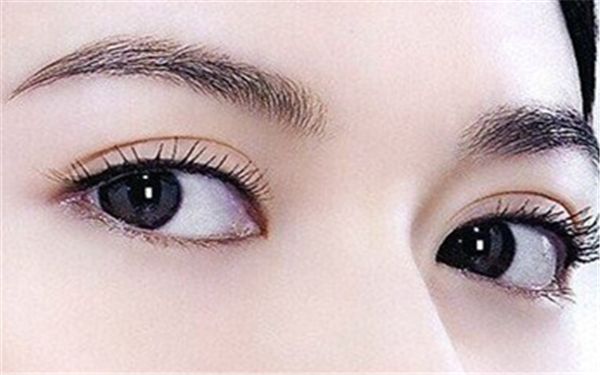 如何選擇北京雙眼皮埋線哪家好？細(xì)致評級幫您快速決策！