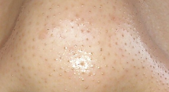 2023承德自體脂肪填充塑型前十名的專家(魏國祥、王紅、韓永剛都是高人氣專家！)