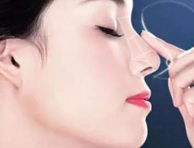 上海激光祛斑手術(shù)哪家好，選擇專業(yè)激光美容醫(yī)院聰明之選