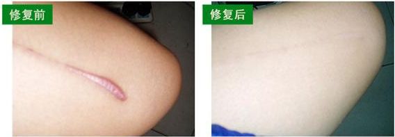 新鄉(xiāng)市眼袋手術哪家好？選擇新鄉(xiāng)市口碑最佳的眼袋手術醫(yī)院