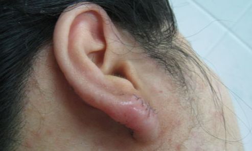 南京下頜骨整形醫(yī)院排名及口碑如何？