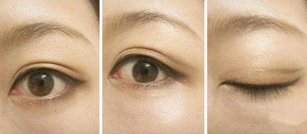 長(zhǎng)春激光祛雀斑醫(yī)院哪家好？解讀頂級(jí)激光技術(shù)，助您雀斑快速消除！